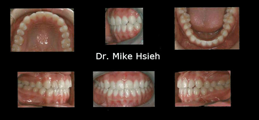 dentist open late in mill creek wa