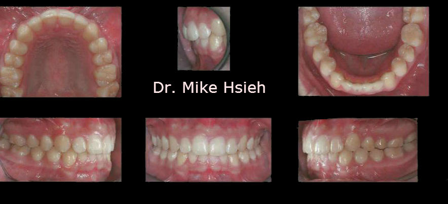 dental wa mill creek