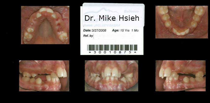 mill creek wa dentist